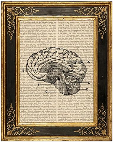 Студио за сонувања, Медицинска илустрација за човечки мозоци Уметнички печати на страница со антички книги, 8x10,5