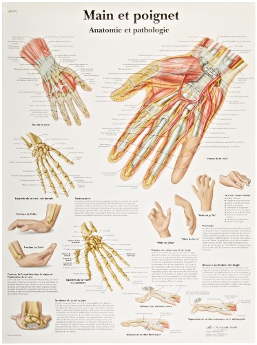 3B Научен VR2171UU сјајно хартија Главна ET Poignet Anatomie ET Pathologie Chart, големина на постер 20 ширина x 26 Висина