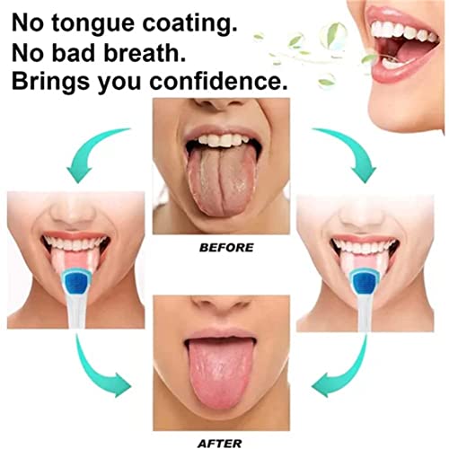 Гел за чистење на орална хигиена на Дашенран и гел за чистење на јазици, гел за чистење на пробиотик јазик, гел за чистење на пробиотик