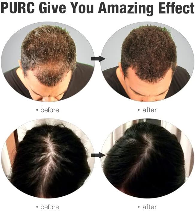 2 ПЦС 300мл Шампон за задебелување на косата мажи жени длабоко скалп фоликула Анти-падна коса промовира шампон за раст на косата 件装