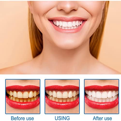 Заби за белење на заби чисто заби за белење на заби за заби, интензивни заби за отстранување на дамки ја намалуваат пожолтувањето