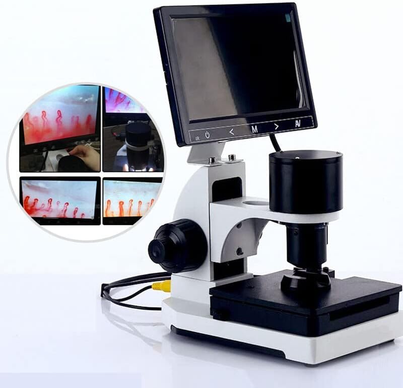 Детектор за микроциркулации на ноилфолд, дигитален микроскоп инструмент за крв микроциркулација LCD дисплеј по избор