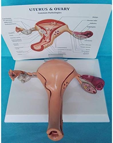 Модел на настава, модел на модел на склопување Модел Настава за анатомска човечка матка, јајници и патологии на матката Напредна симулација модел